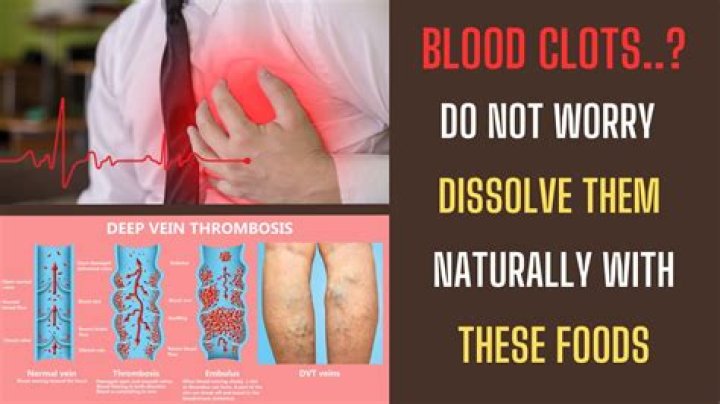 Can blood clots go away naturally?