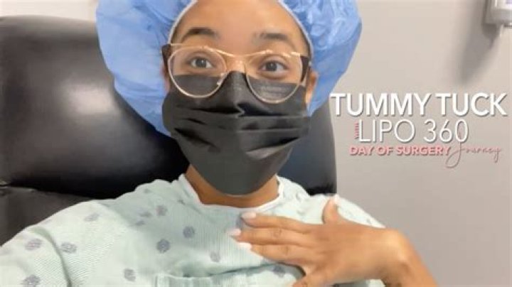 Can morbidly obese get liposuction?
