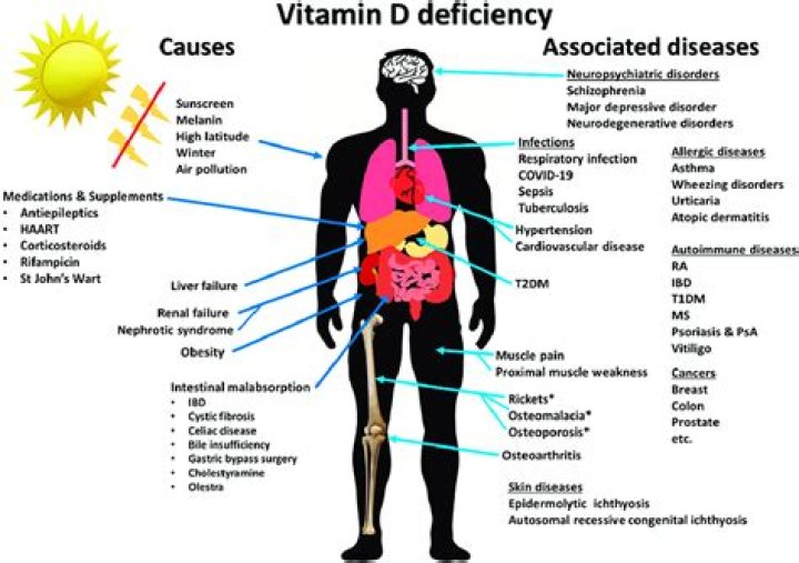 Does low vitamin D mean diabetes?