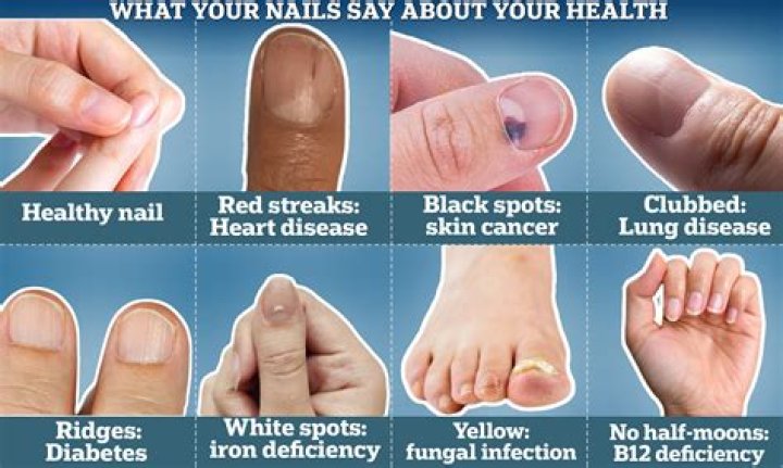Does magnesium deficiency show up on blood tests?