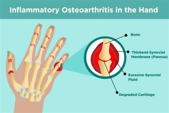 How does arthritis make you feel?