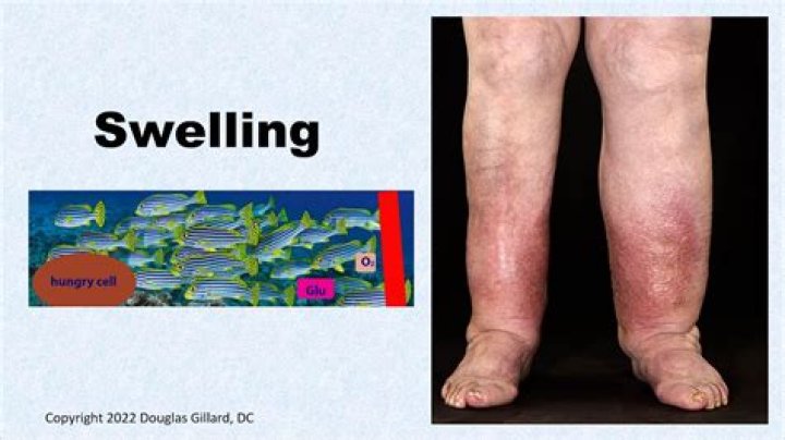 Is swelling good for healing?