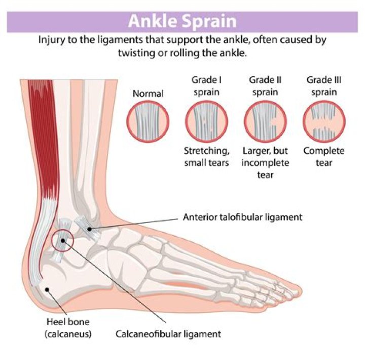 What can make an ankle sprain worse?