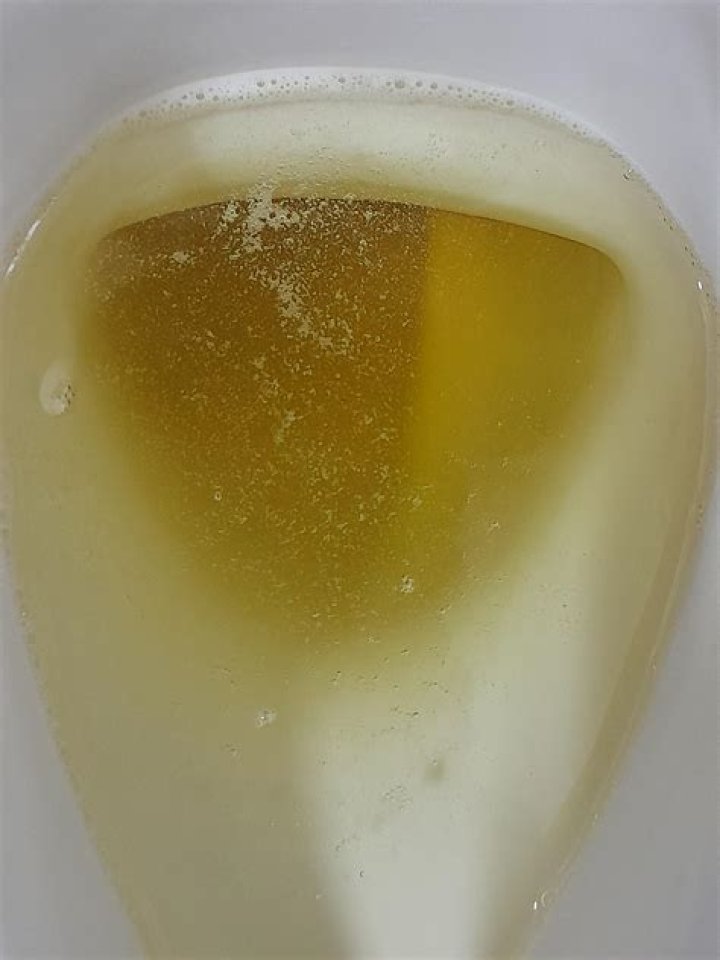What is the white stuff that comes out of piercing holes?