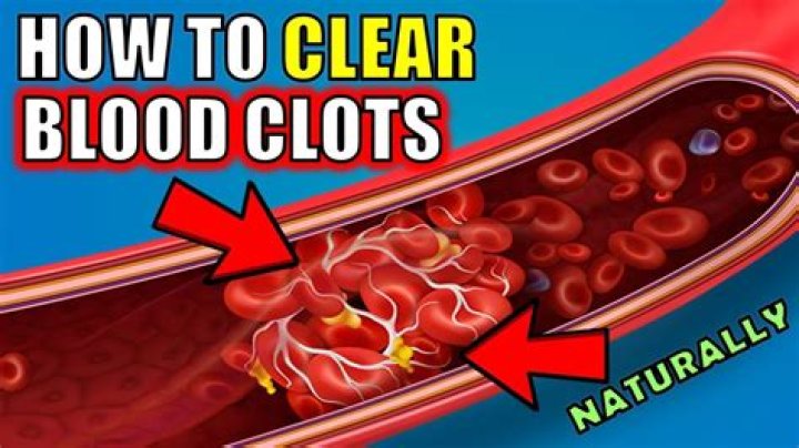 What should you not do when you have a blood clot?