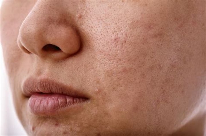 Why is my skin dull and GREY?
